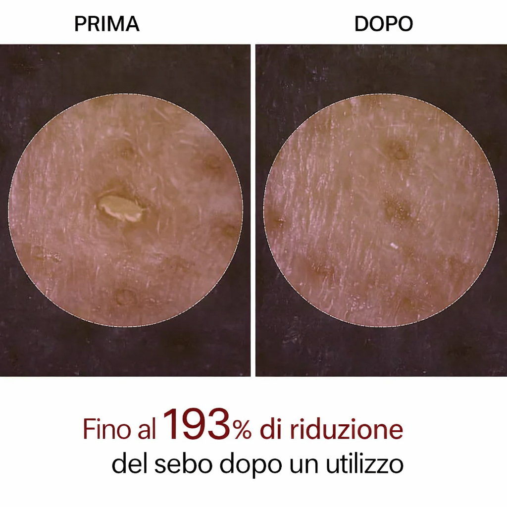 Peel Shot Coreano – Elimina le Impurità ed Esalta la Tua Pelle